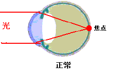 正常