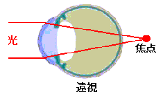 遠視