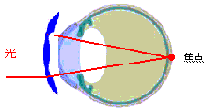 図２　OKレンズを装用 