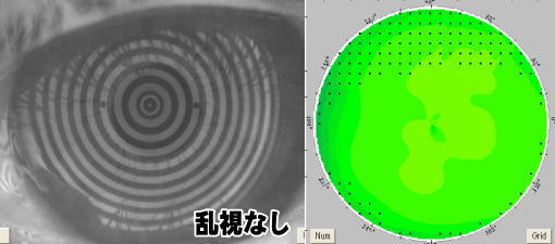 [乱視なしの角膜形状]